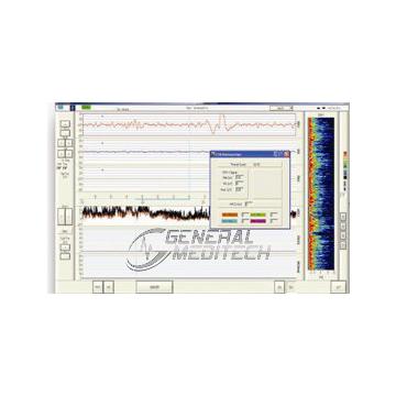 Монитор церебральной функции (CFM)